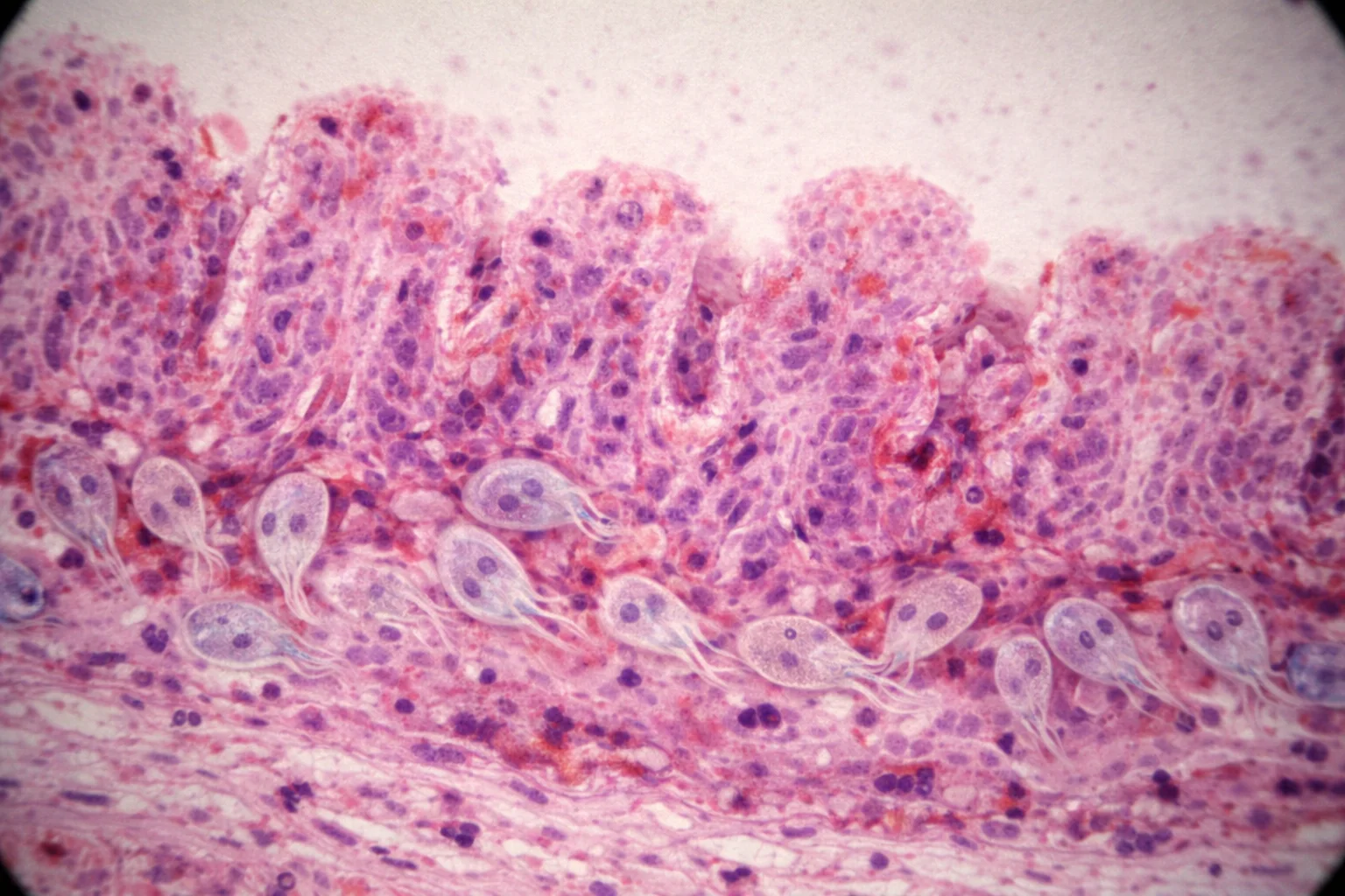 Tkanka jelita po zkazeniu giardia